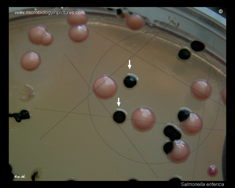 salmonella and klebsiella on desoxycholate citrate agar